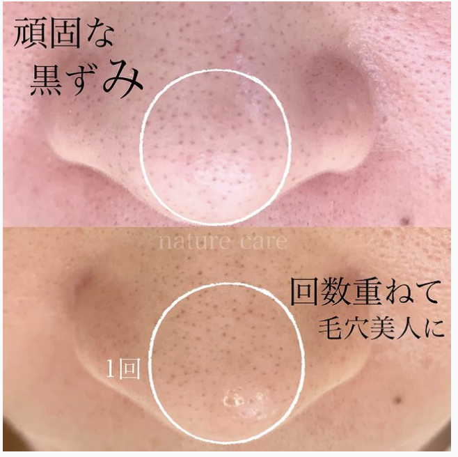 フェイシャル｜ナチュレ｜水戸